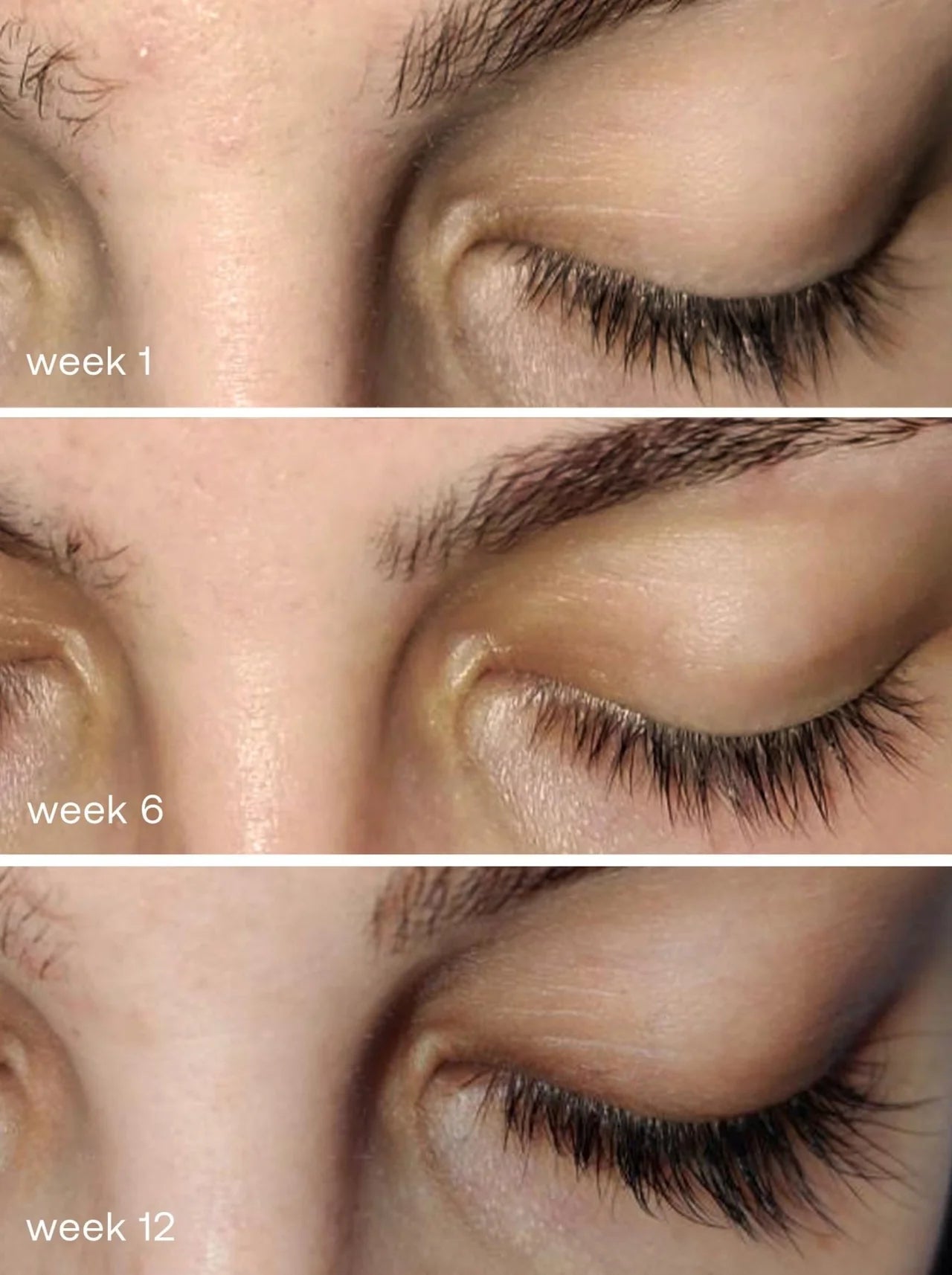 Eyelash Growth Serum for Longer, Fuller Lashes