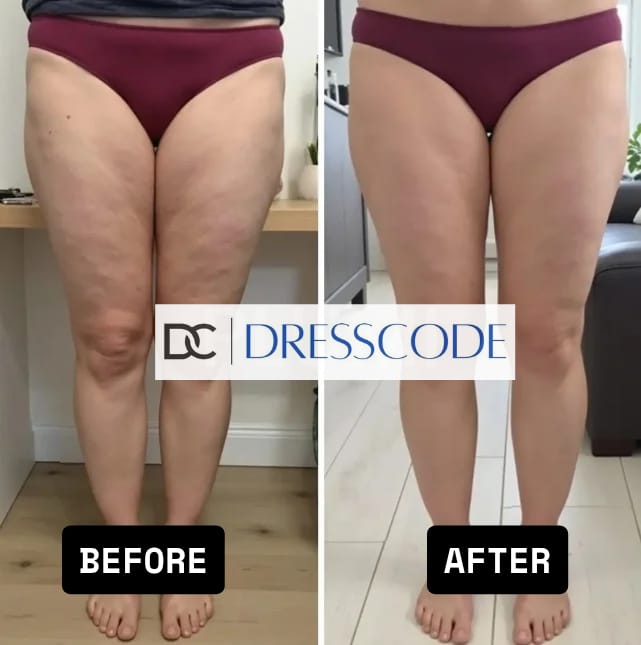 CurveFlex® Leggings | High compression with technology that helps reduce the appearance of cellulite