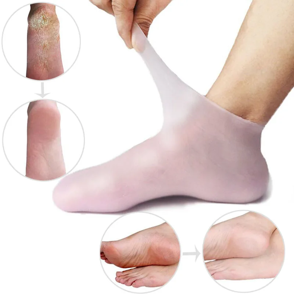 Moisturizing Silicone Socks – Deep Hydration and Relief for Dry Feet